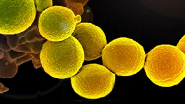 White_blood_cell_with_MRSA-National%20Institutes%20of%20Health%20%28NIH%29-small